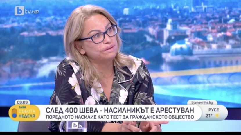 Послание за момичето със 400-те шева от жената залята с киселина в ефир