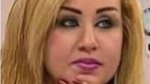Тя премина през 43 козметични процедури, за да стане Барби, но всички ѝ казват, че е „зомби“ СНИМКИ